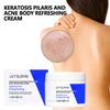 Smooth and Clear Skin with Our Body Repair Cream for Blemishes