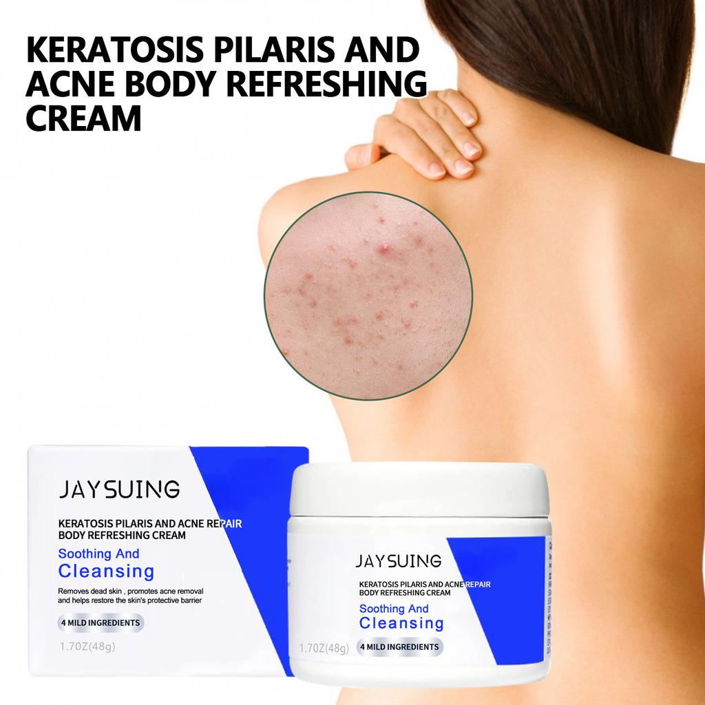 Smooth and Clear Skin with Our Body Repair Cream for Blemishes