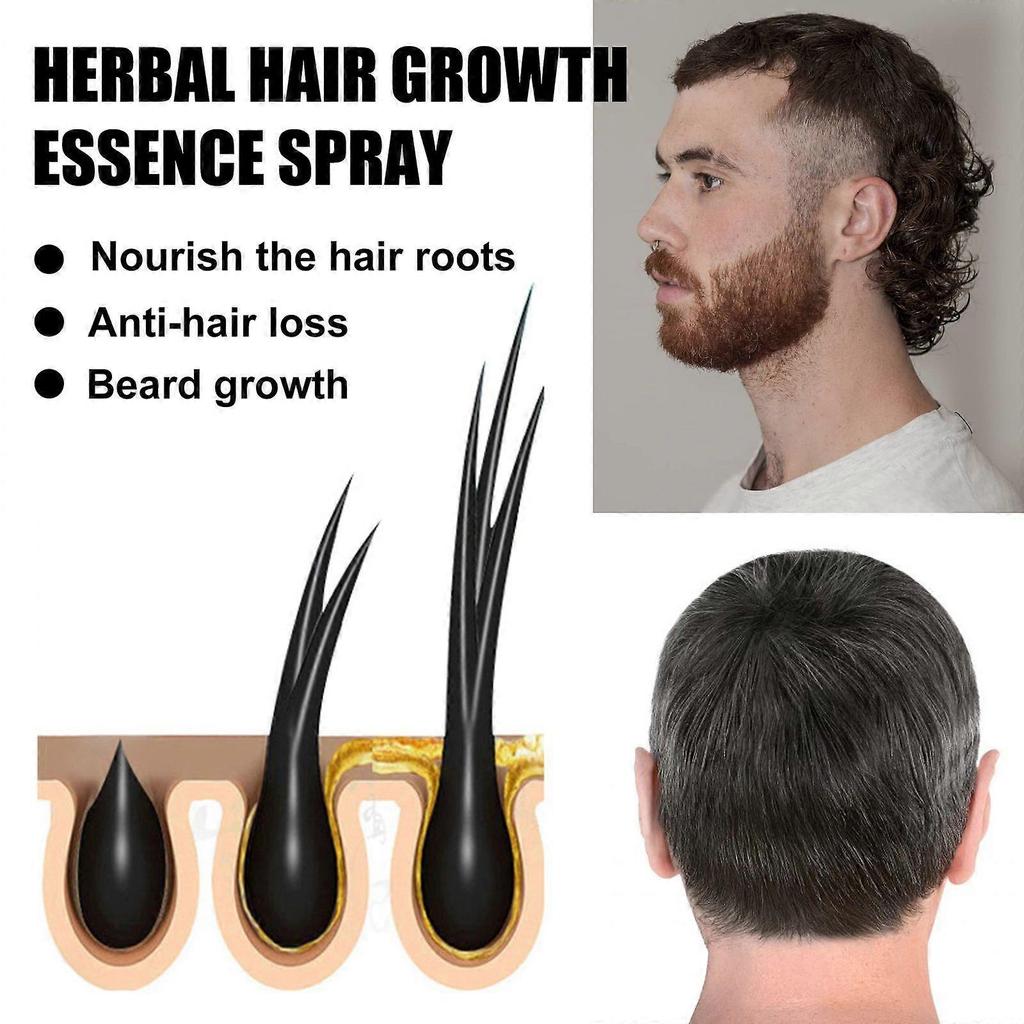 Herbal hair care roller essential oil hair scalp nourishing nutrition care solution 30ml set