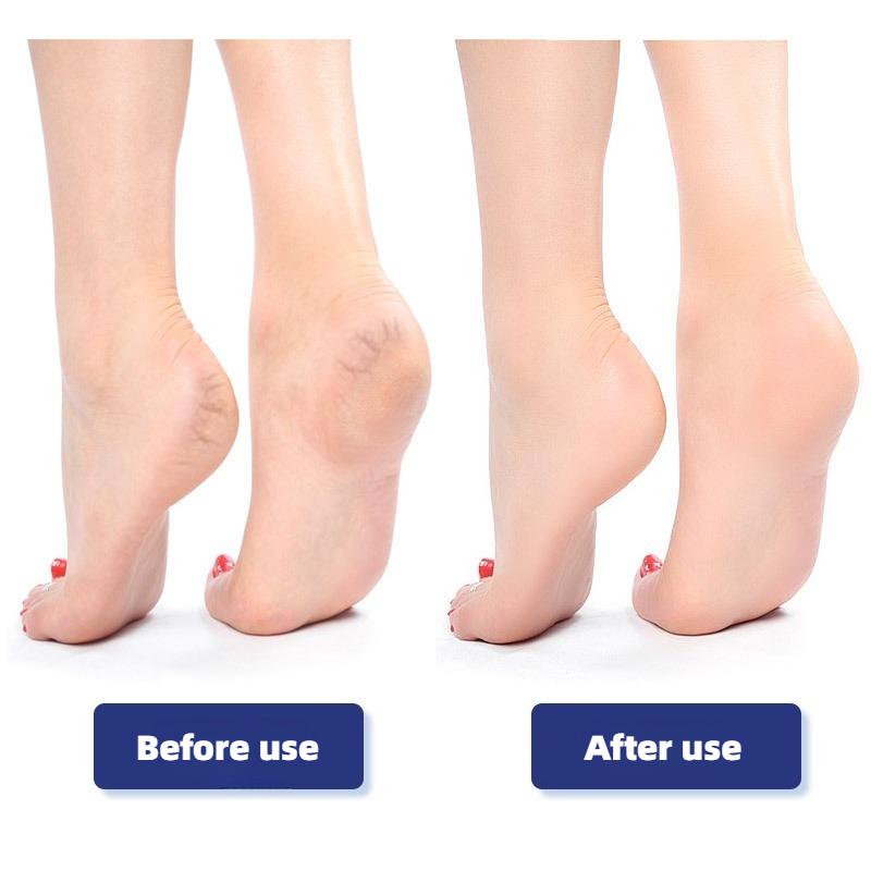 Foam Glass Foot Grinding Stone Foot Files Dead Skin Remover Feets Heel Scrubber Smooth Feet Pedicure Exfoliator Foots Care Tools