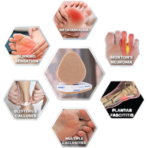 20 Felt Metatarsal Pads for Men and Women, Adhesive Forefoot Pads, Cushioning Foot Pads for Forefoot and Sole Support and Protective Pads