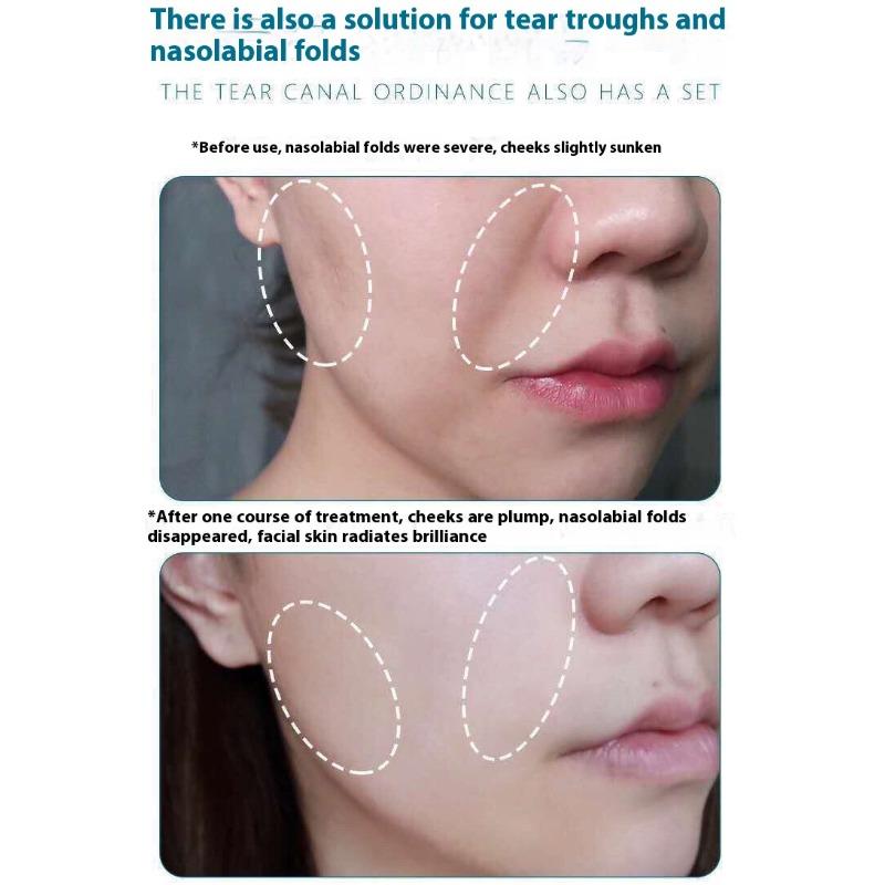 Fengying Elasmizing Essence Fills Apple Muscle Fengface Essence Huafeng Forehead Tear Groove Lifting