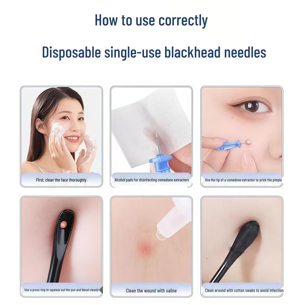 Ultra-Fine Tip Disposable Pimple and Blackhead Removal Needle