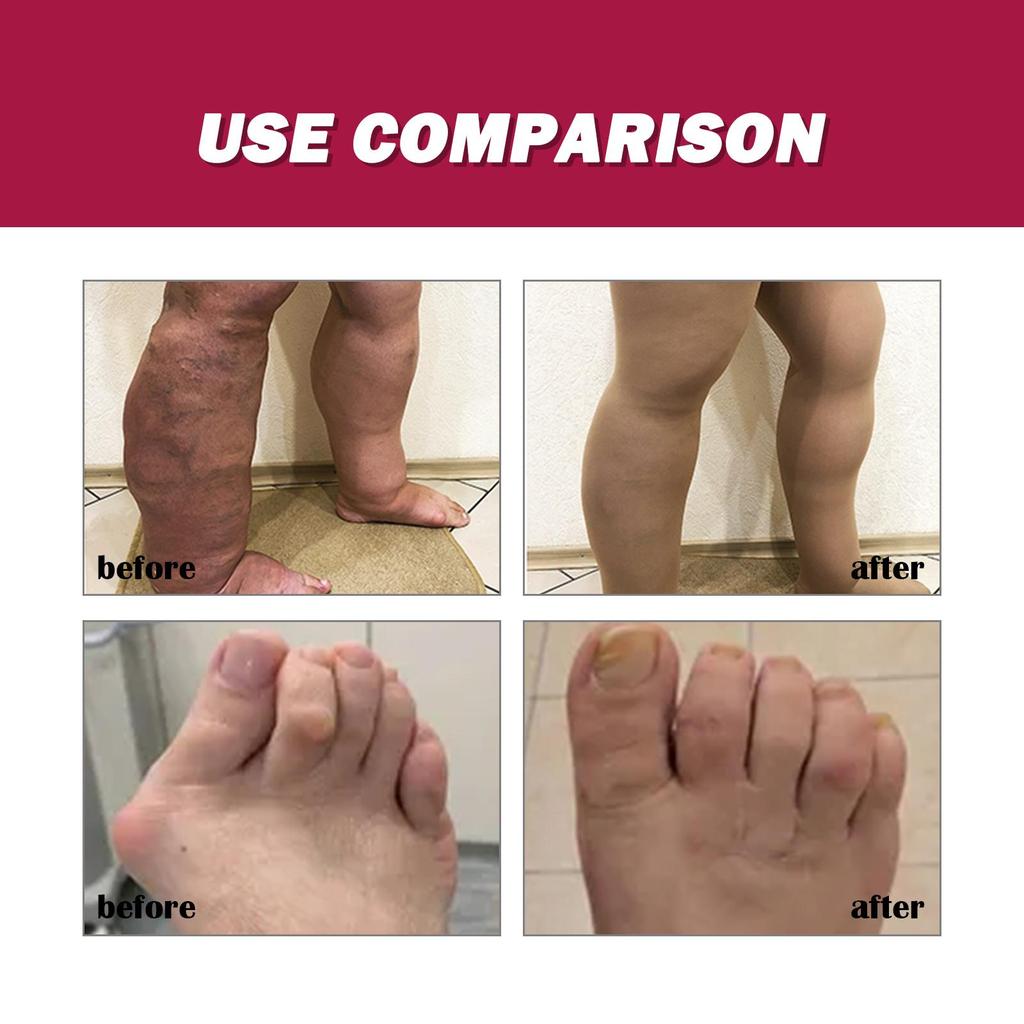 South Moon Collagen Cream for Joints and Bones Enhance bone injury recovery and recovery activities, and restore bone health.