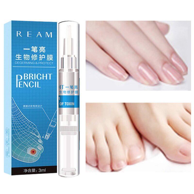 

Средство для ногтей Уход за ногами Эссенция Отбеливание ногтей на ногах Ноготь на пальце ноги