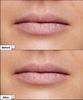 Vital Hydra Solution Hydrating Lip Mask 20g
