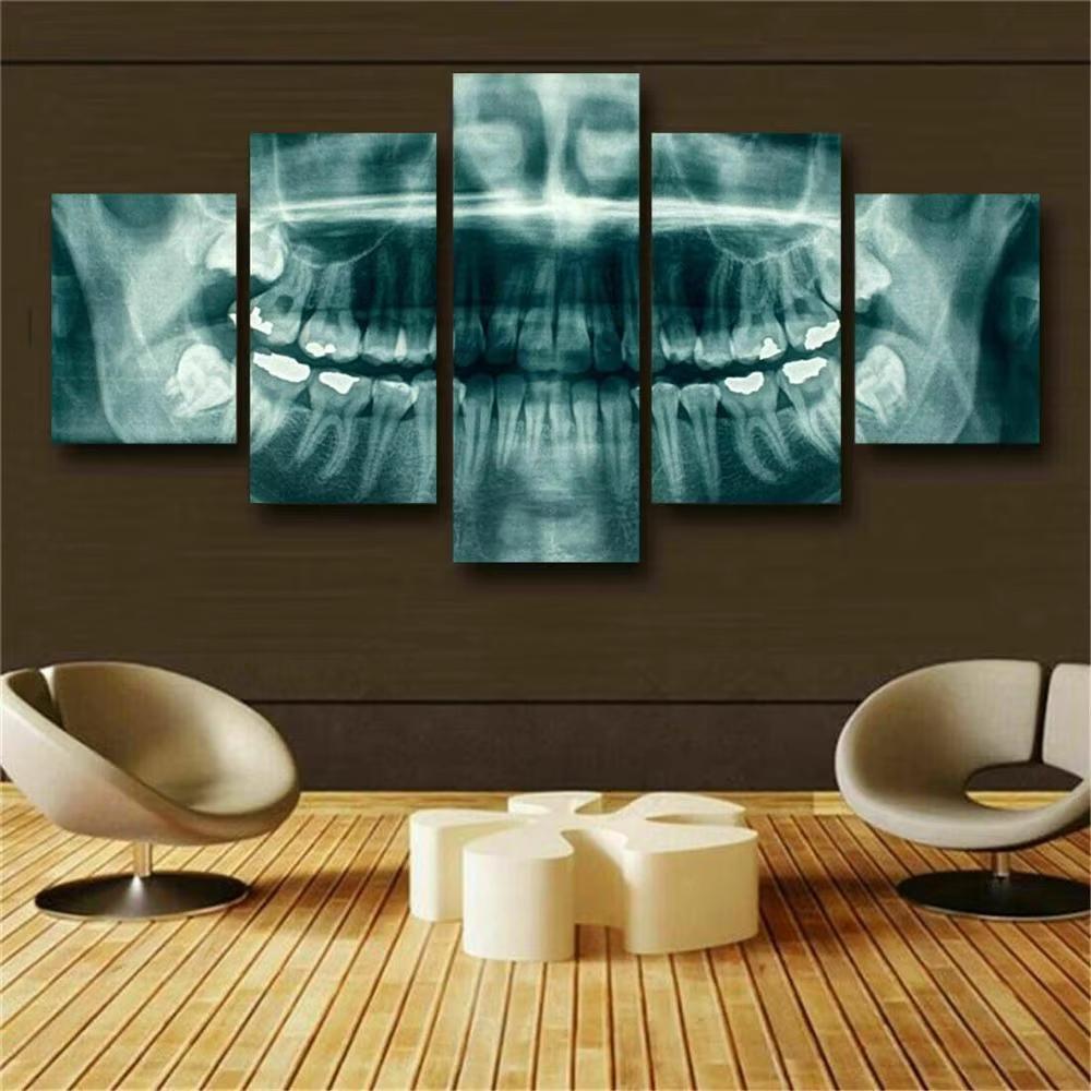 Pintura em Tela de Dentista com Raio-X Dental, Arte de Parede, Impressão de Poster, Decoração de Casa, Imagens Impressas Sem Moldura, Decoração de Quarto com 5 Painéis