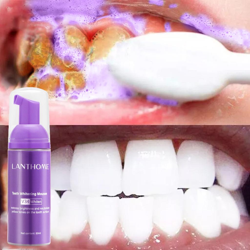 V34 Teeth Whitening Mousse – Stain Remover & Breath Freshener
