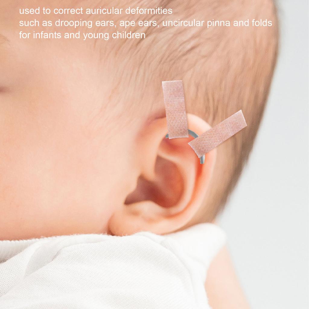 Baby Ear Corrector Auricle Silicone Correction Patch Skin Friendly Comfortable Baby Gel Ear Tape