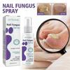 2Pcs Nail Fungus Spray, Toenail Fungus Treatment, Nail Care Solution for Toenail Feet, Fast Itch Relief