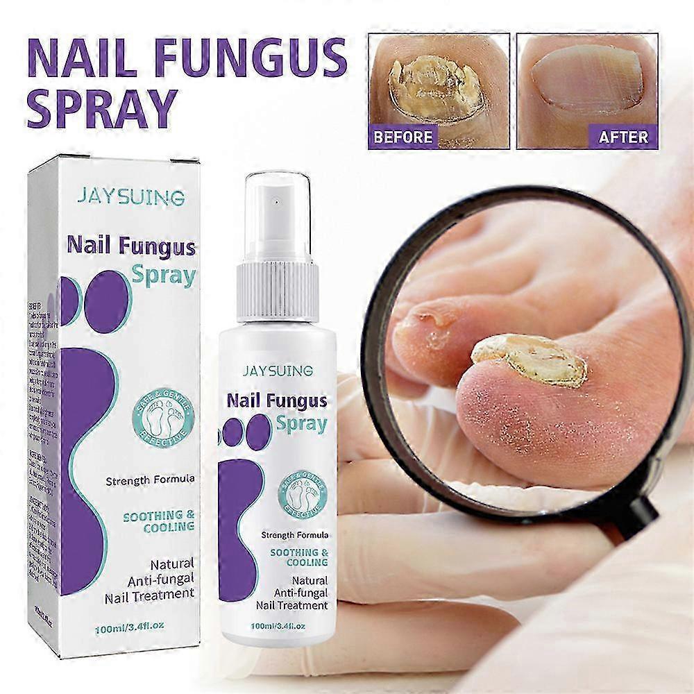 2Pcs Nail Fungus Spray, Toenail Fungus Treatment, Nail Care Solution for Toenail Feet, Fast Itch Relief