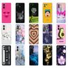 Xiaomi Mi 11 / Mi 11 Lite 5G NE 4G / Mi 11i / Mi 11 Ultra Case telefonhoz Hátlap xiaomi11 i 11Lite Xiomi Mi11 Silicon TPU-hoz