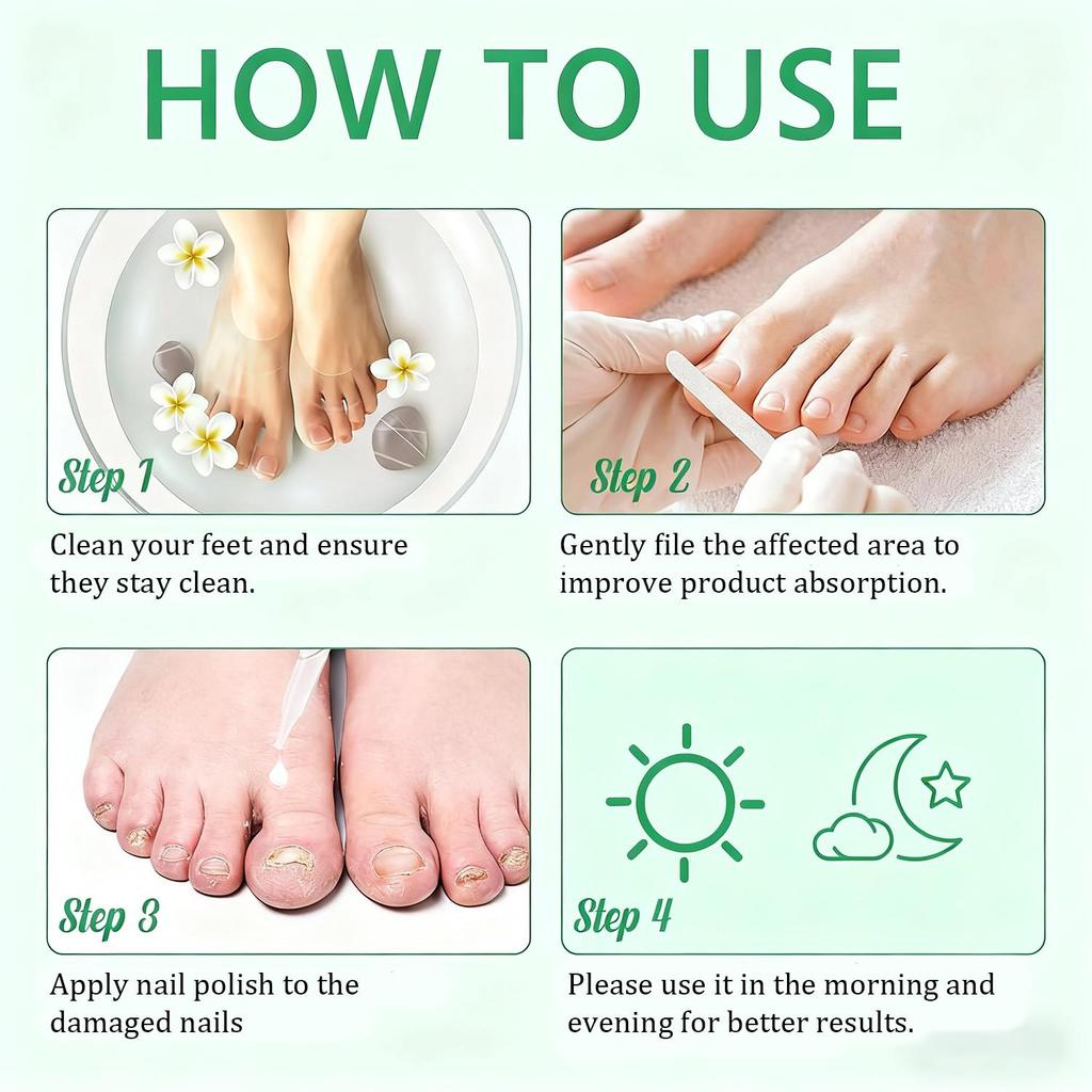 7D Ingwer & Bienengift Nagelöl-Stärkt Nägel für gesundes Wachstum-Eliminiert schädliche Keime-30ml