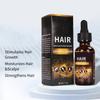 Hair Growth Serum 30ml - Anti-Hair Loss Scalp Treatment for Thicker Stronger Hair Follicles & Fast Growth