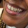 1 Stück Goldfarbener Alltagstauglicher Zahnschmuck Dental Grillz Hip Hop Hohles Herz Zahn Grillz Für Frauen
