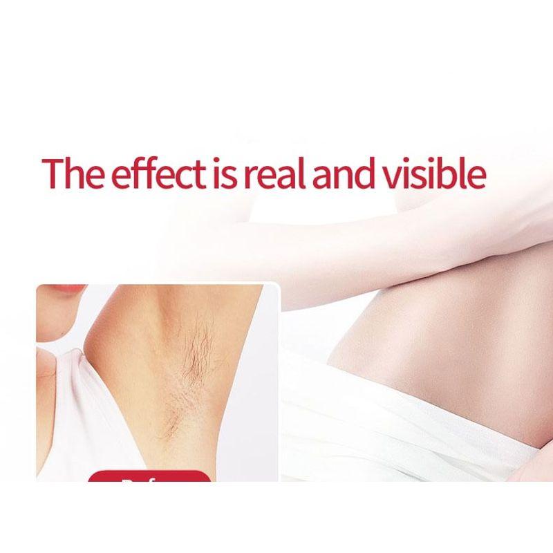 HOMTEC - Wiederaufladbarer Gesichts-Haarentferner