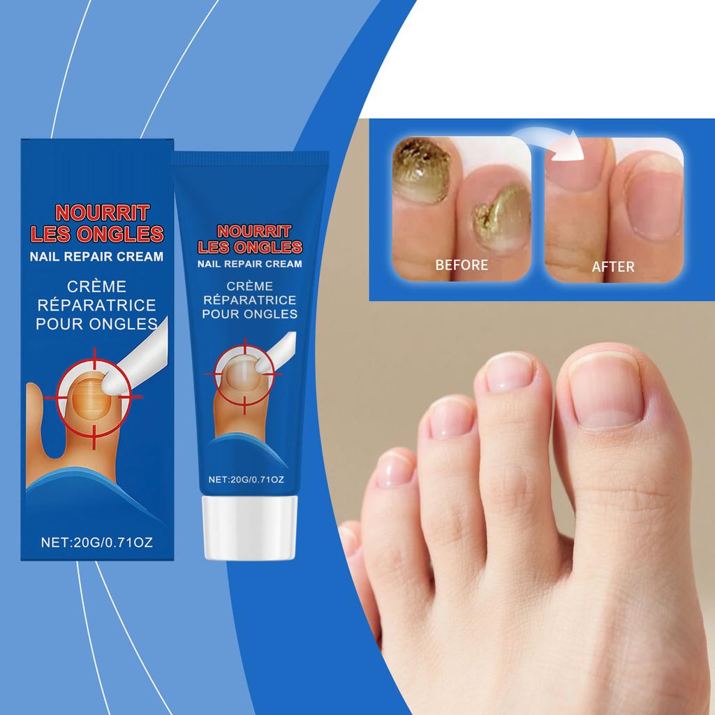 Nail Care Cream Soothes And Nourishes The Nail Bed, Deeply Moisturizes And Hydrates, Increases Thickness, And Enhances The Appearance Of Nails.