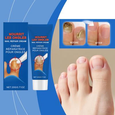 Nail Care Cream Soothes And Nourishes The Nail Bed, Deeply Moisturizes And Hydrates, Increases Thickness, And Enhances The Appearance Of Nails.