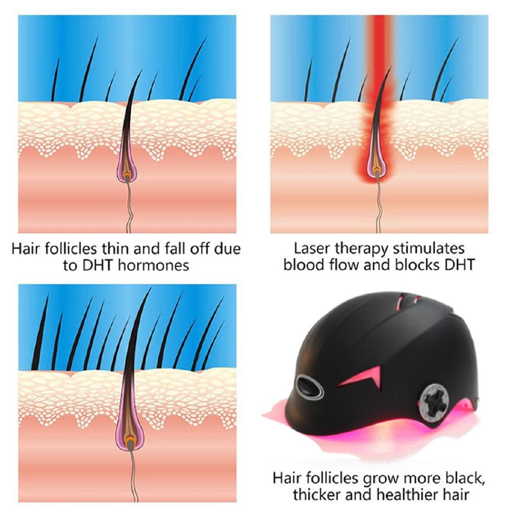 USB Adjustable Hair Regrowth Laser Cap 128 Diodes Hair Fast Regrowth Machine with Free Glasses New Black Helmet Hair Loss Upgrate Therapy Laser