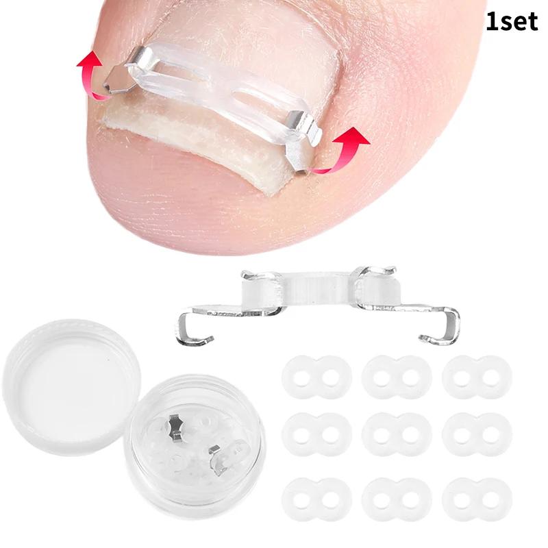 

Set Tool 1/2 Ingrown Toenail Corrector Pedicure Recover Embed Treatment Professional Foot Care Correction