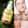 1 Bottle Turmeric Essence, Facial Care, Facial Serum, Nourishing & Moisturizing, Smooth Skin, Repair