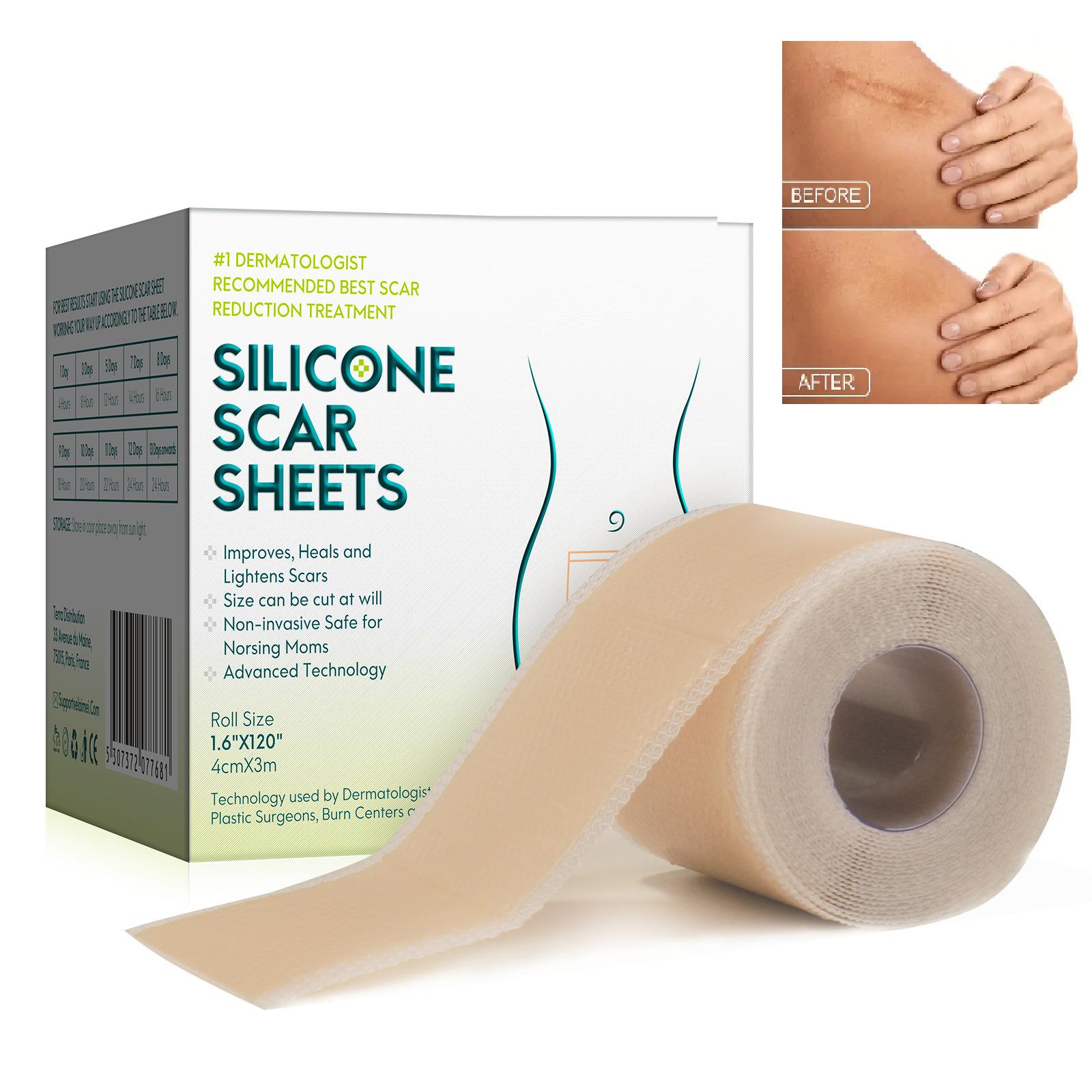 

Силиконовые наклейки на шрамы. Медицинская силиконовая легко отрываемая гелевая лента в рулоне. Медицинский класс. 4cm*3m