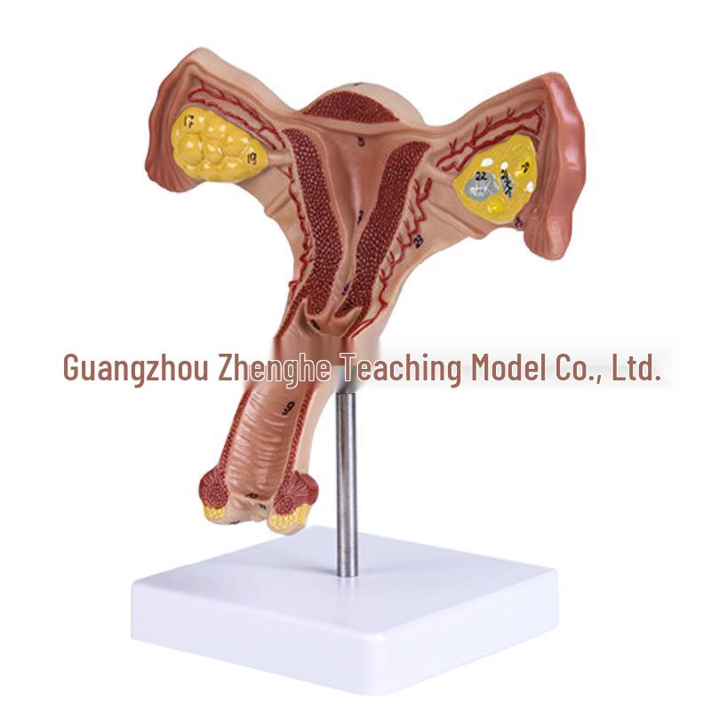 Female Pathology Uterus Model for Obstetrics & Gynecology Education