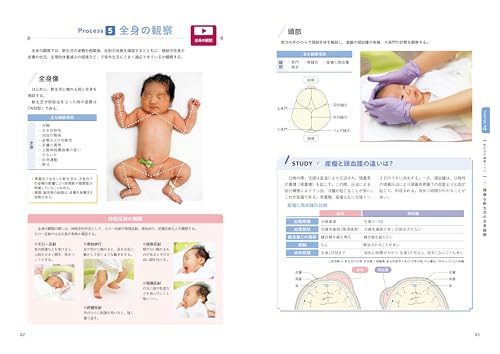 Newly revised 2nd edition: Advanced Maternal Nursing Techniques explained in photos