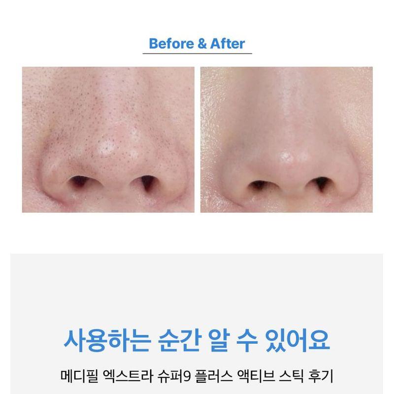 MEDIPEEL - Extra Super 9 Plus Aktiver Stick