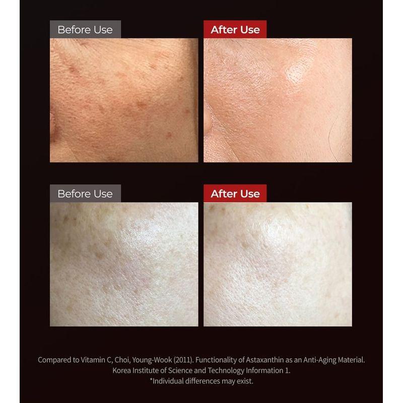 Dr.Melaxin - Astaxanthin Anti-Freckles & Whitening Capsule Cream