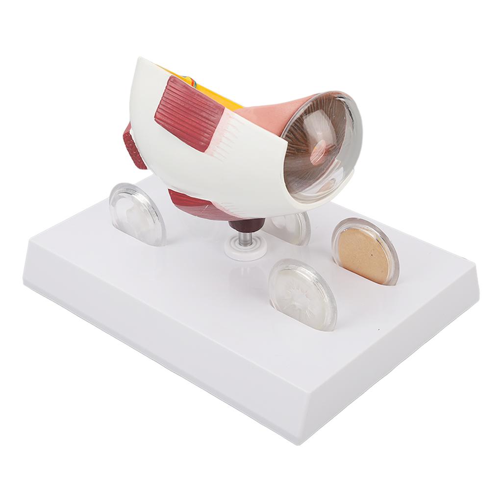 Eyeball Lesion Model Enlarged Human Eye Anatomical Model Accurate Shows Optic  Cornea  Lens  Eyeball Model