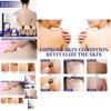 Jaysuing Back Care Spray For Fading Acne Marks And Smoothing Skin Texture
