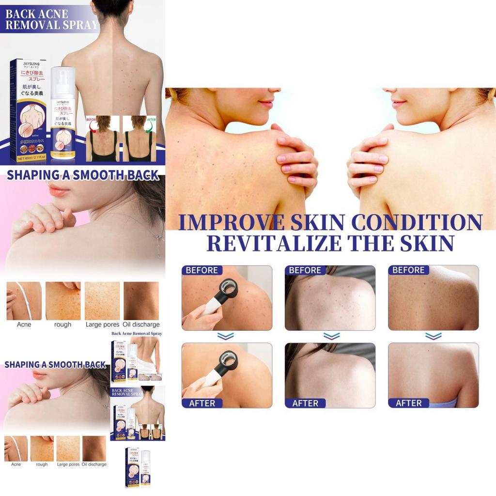 Jaysuing Back Care Spray For Fading Acne Marks And Smoothing Skin Texture