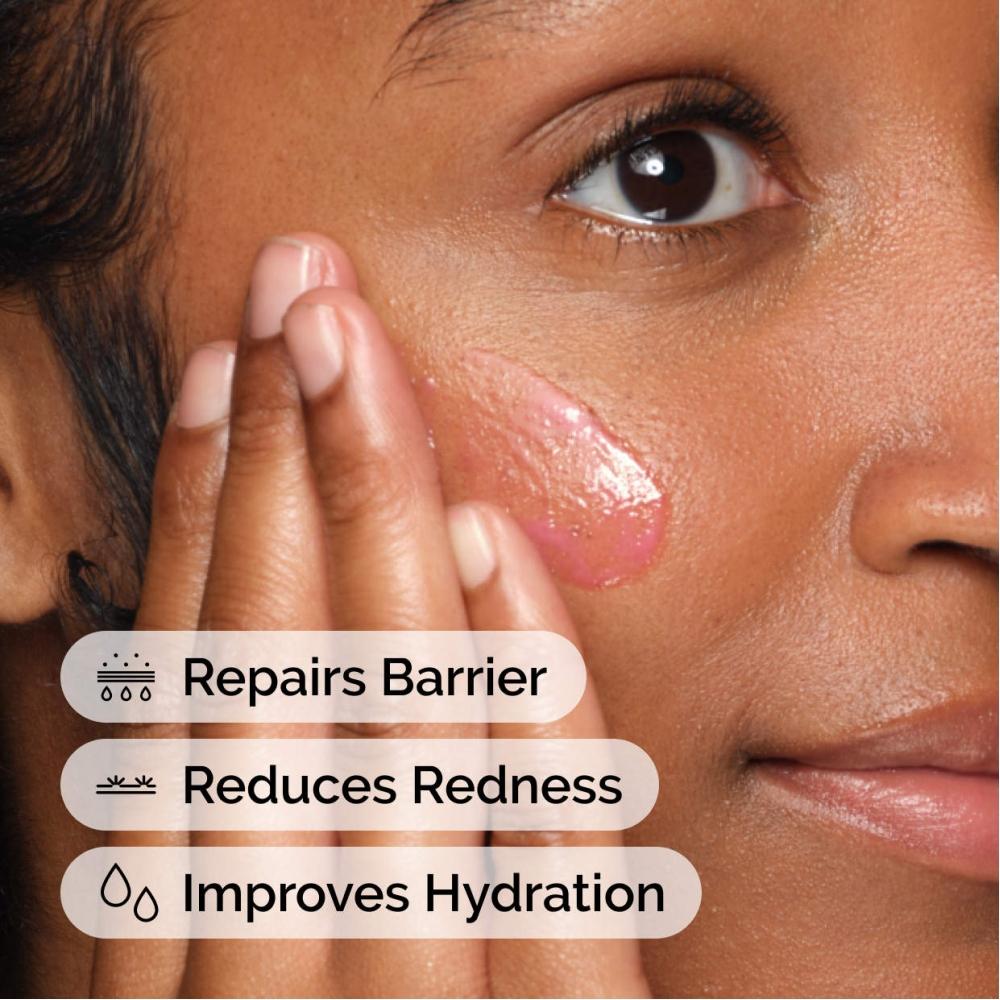 The Ordinary Soothing   Barrier Support Serum For Sensitive Skin 1 Oz