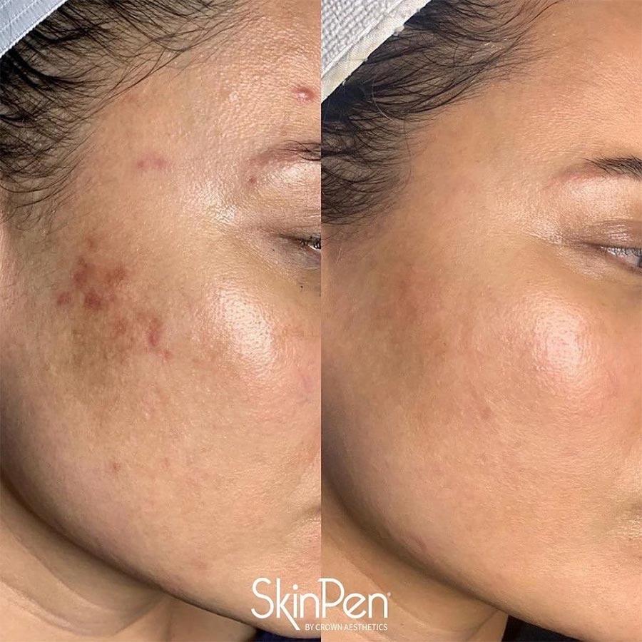 Dark Spot Corrector Skin Whitening Fade No Spot Cream 50g | Lightening Blemish Removal Gel, Reduces Age Spot and Black Spots