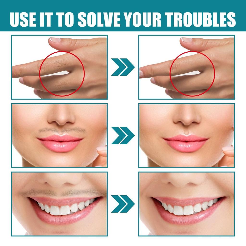 Facial Hair Removal Upper Lip Chin Peach Fuzz Hair Removal Moisturizing Hair Removal For Women Facial Mustache