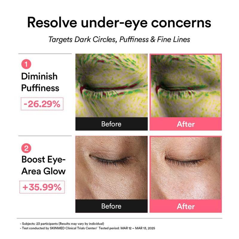 Abib - PDRN Retinal Eye Patch Glow Jelly