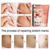 Skin Care Cream Gentle Care Smoothing Skin Tighten Tummy Massage Postpartum Skin Care Cream