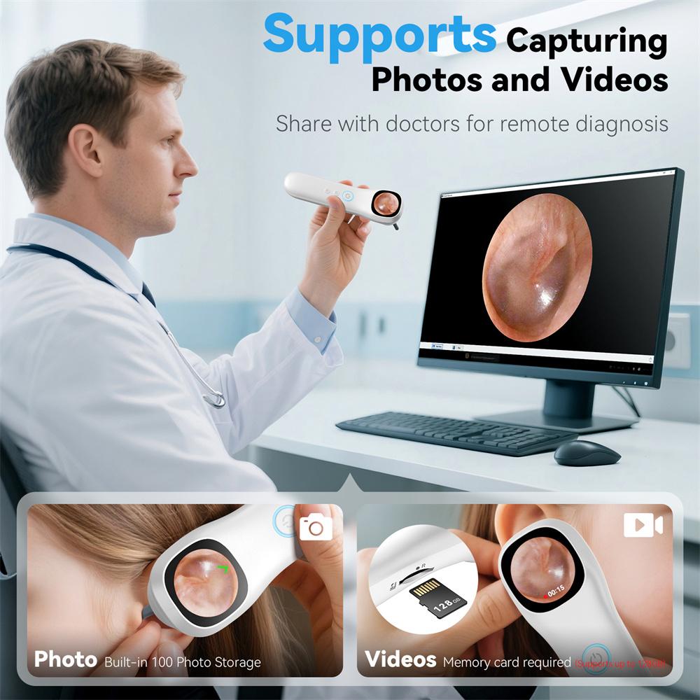1080P HD Ear Camera 5-in-1 Smart Detector with Screen Ear Scoop Set 6 Replacement Ear Scoops 12 Replacement Check Heads Ear Tool