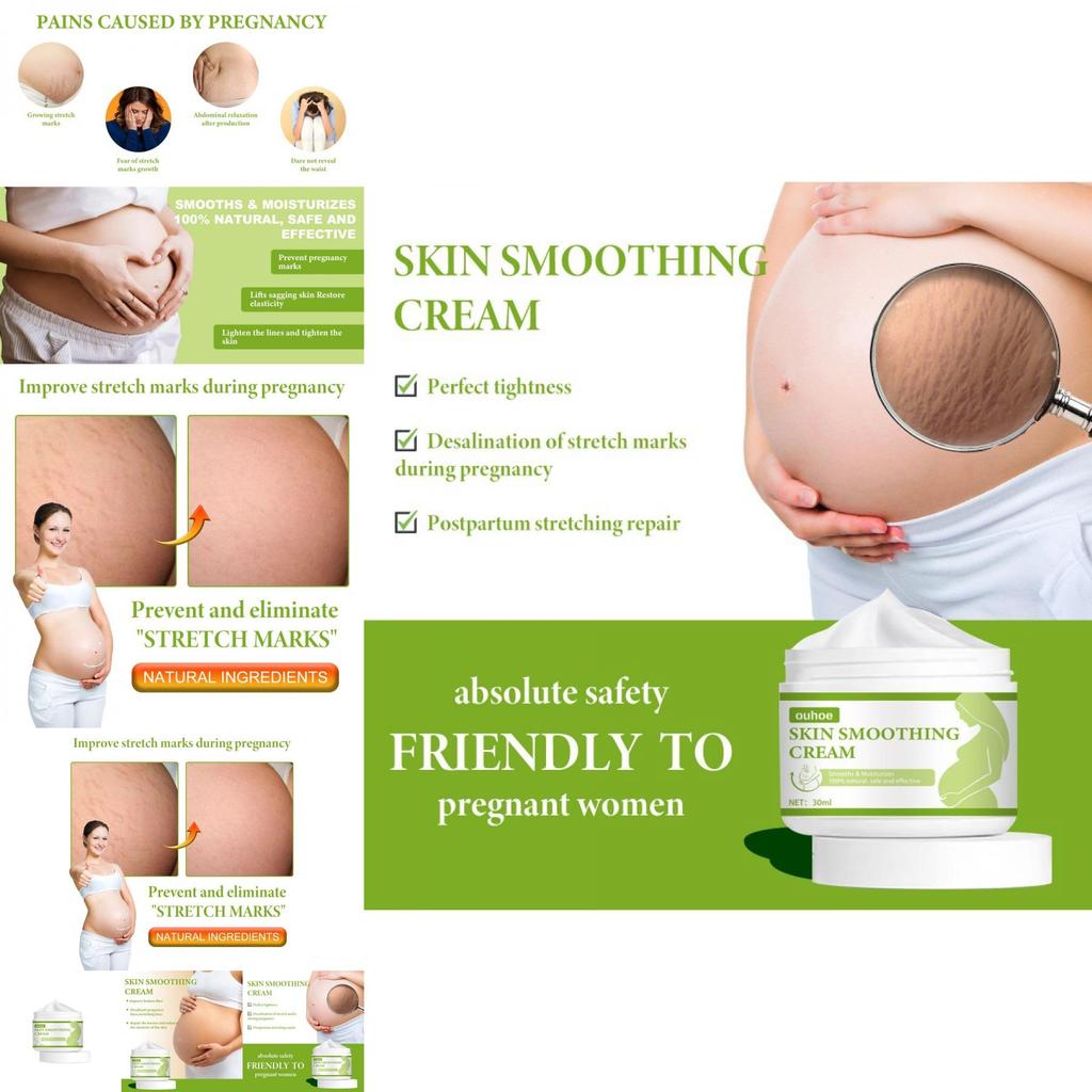 Ouhoe Skin Smoothing Cream Moisturizing Formula For Scar Reduction And Stretch Marks