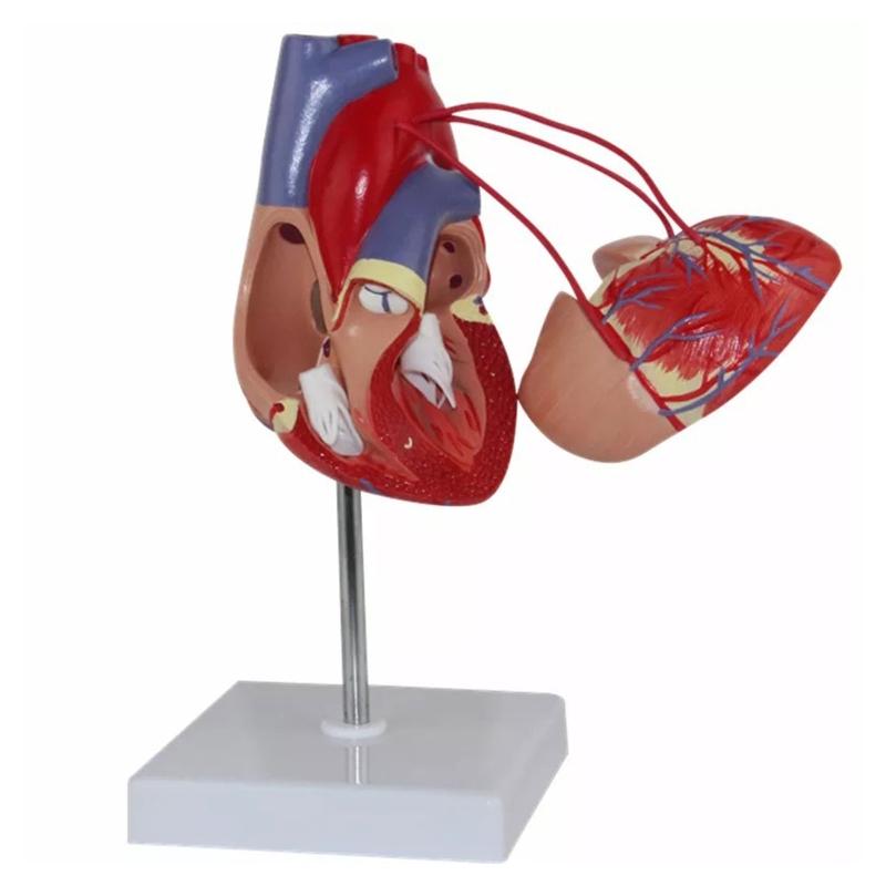 Modello Anatomico di Cuore Umano per Studio Cardiologico che Dimostra il Bypass Cardiaco