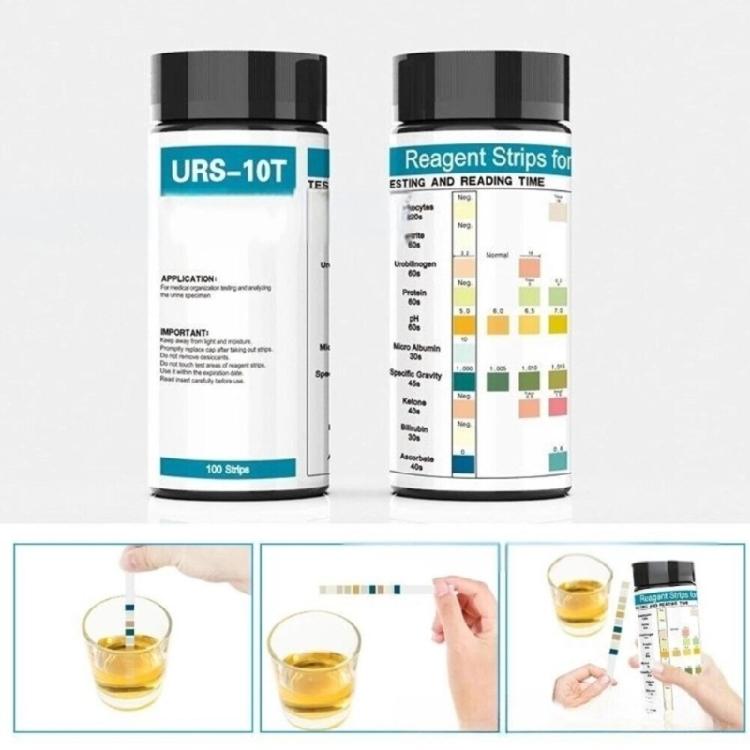 100pcs Urine Test Strips 10 Parameters URS Test Strips for Leukocytes Nitrite Urobilinogen 10-in-1 Urine Testing Strips