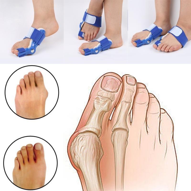 

День ночь Банен шины большие пальцы корректор Hallux Valgus Выпрямитель для волос ног