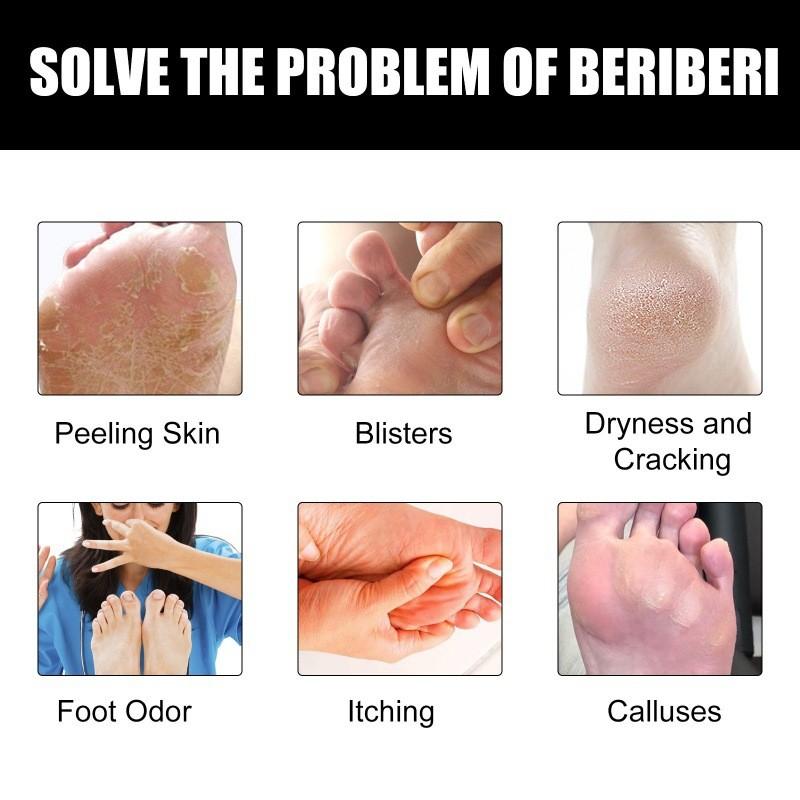 Ximonth Foot Odor Removal Cream With Soothing Formula For Itchy And Dry Skin Care