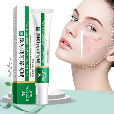 קרם פנים הלבנה קרם לחות אנטי אייג'ינג עם Hexapeptide להסרת כתמים כהים טיפול להסרת נמשים, קרם נגד קמטים לכל סוגי העור