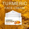 Acne Cream Skin Face Hydrating Moisturizing Acne Cream