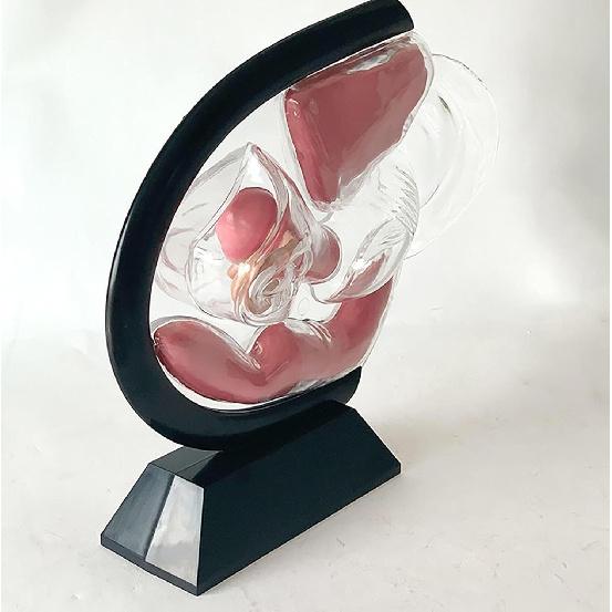Female Transparent Uterus Anatomical Model, Uterus Model, Pelvis Rectum Teaching Model, for Medical Education and Training(Black)
