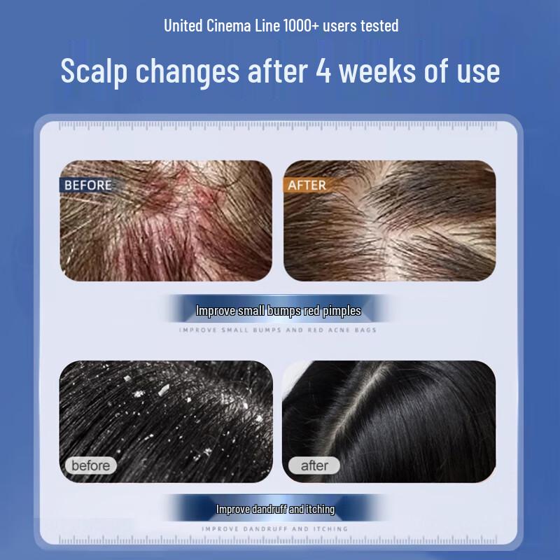 Nanjing Tongrentang Anti-Schuppen & Öl-Kontroll Shampoo