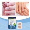 Nail Treatment Patches 72pcs for Fungus Cracked Growth Non Woven Fabric