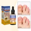 Nail Funguss Treatmenty Strong Nail Repairs Improves Appearance Reduces Discoloration Treatmenty 50ml